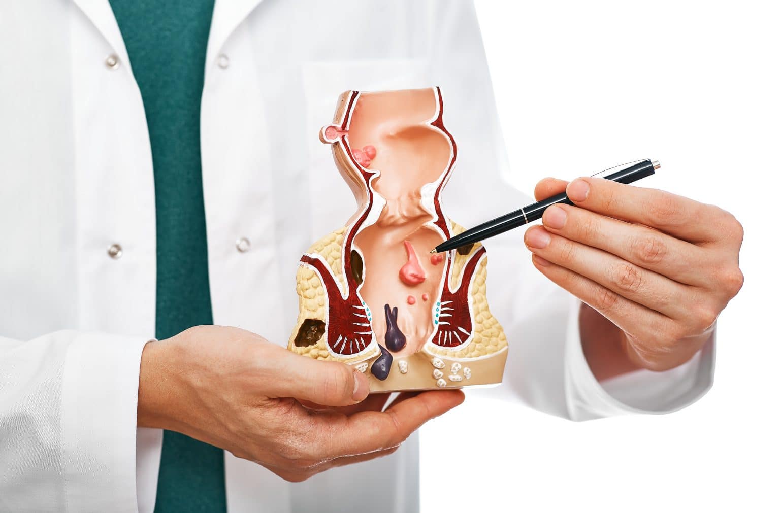 Relatable Colonoscopy Your Colonoscopy Guide: How To Prepare & What To Expect